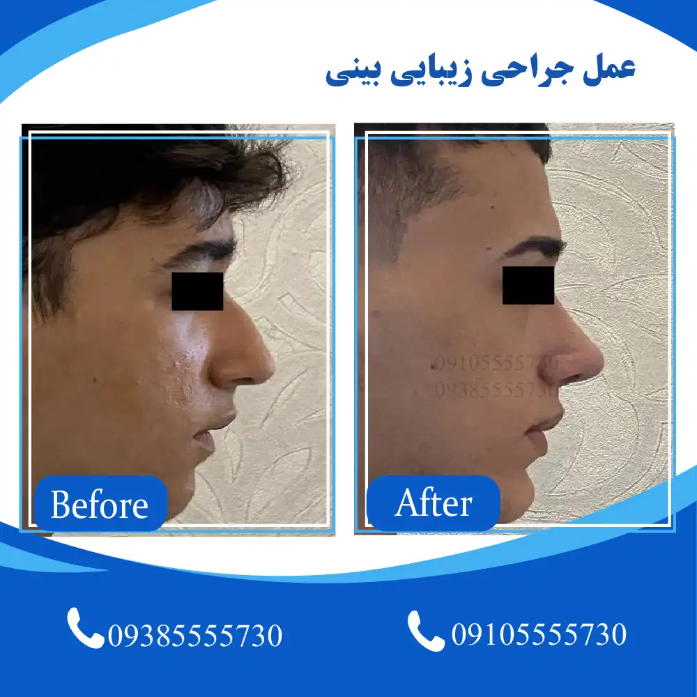 جراح بینی تبریز