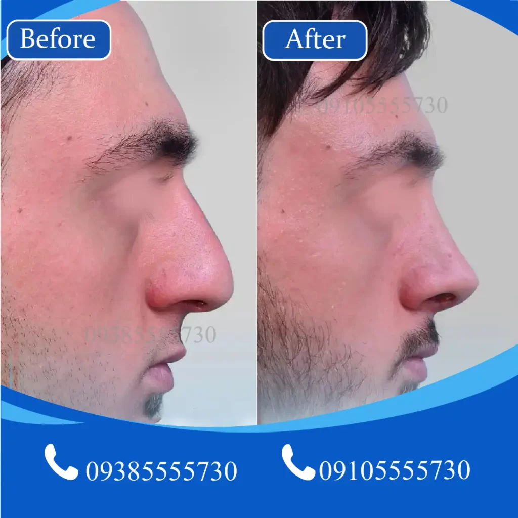 جراح بینی در تبریز