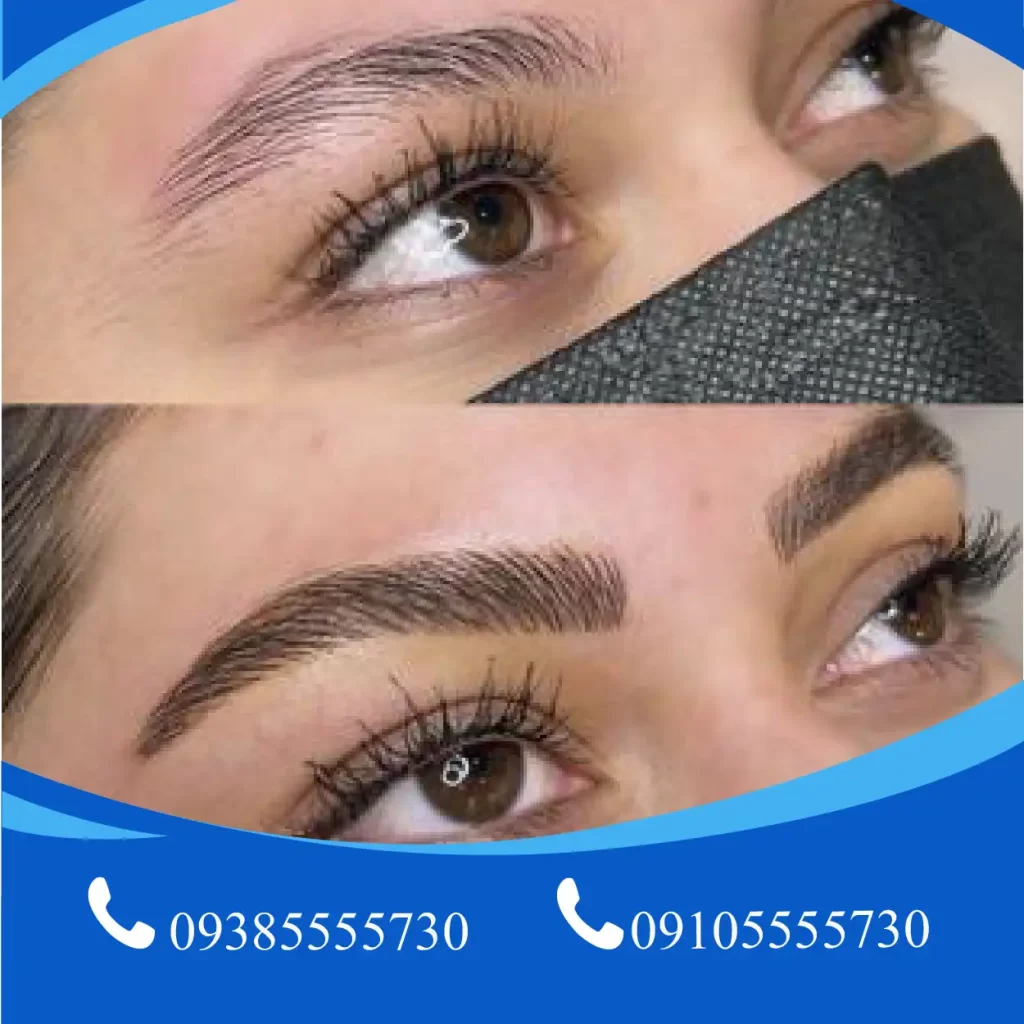 کاشت ابرو طبیعی در تبریز