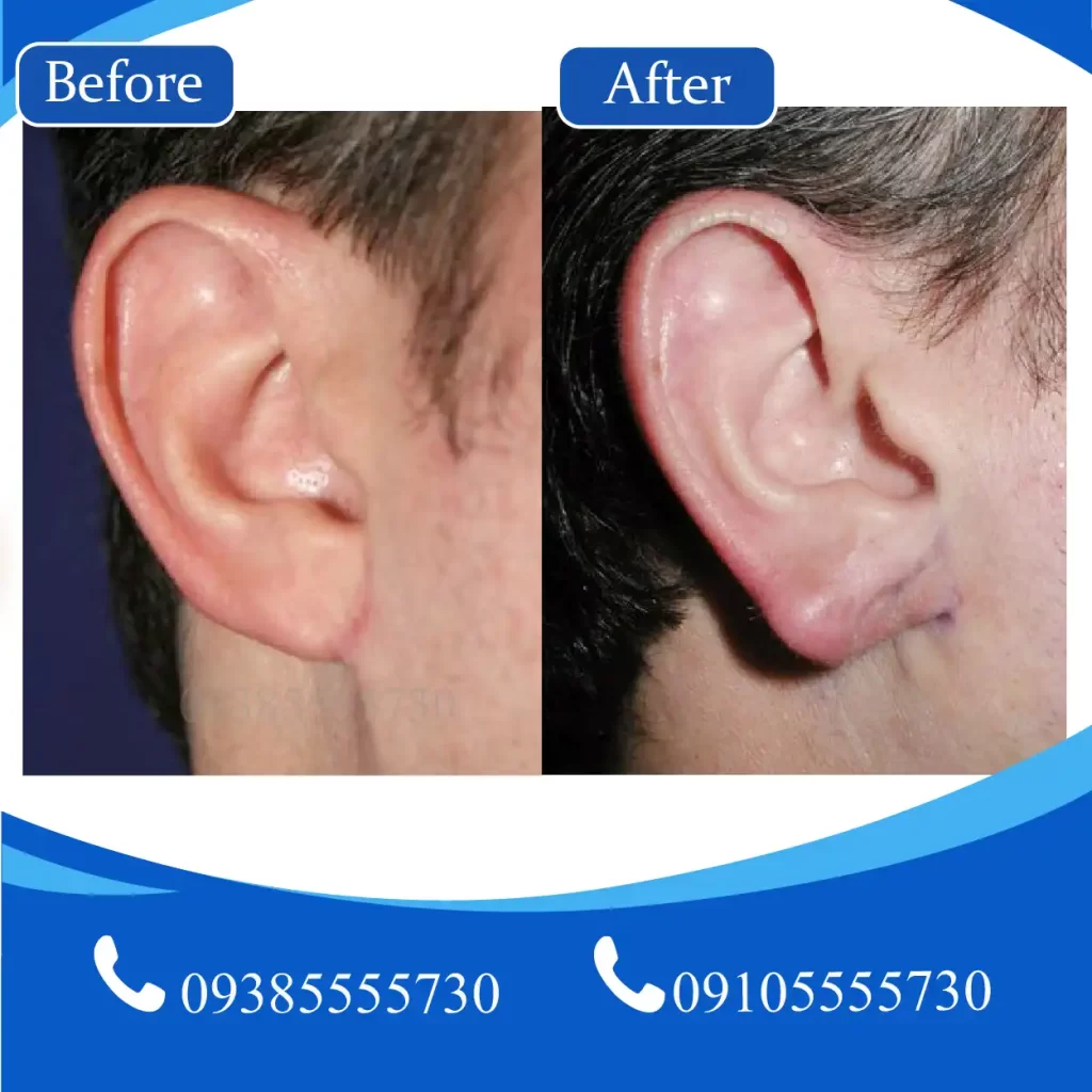 عمل گوش تبریز