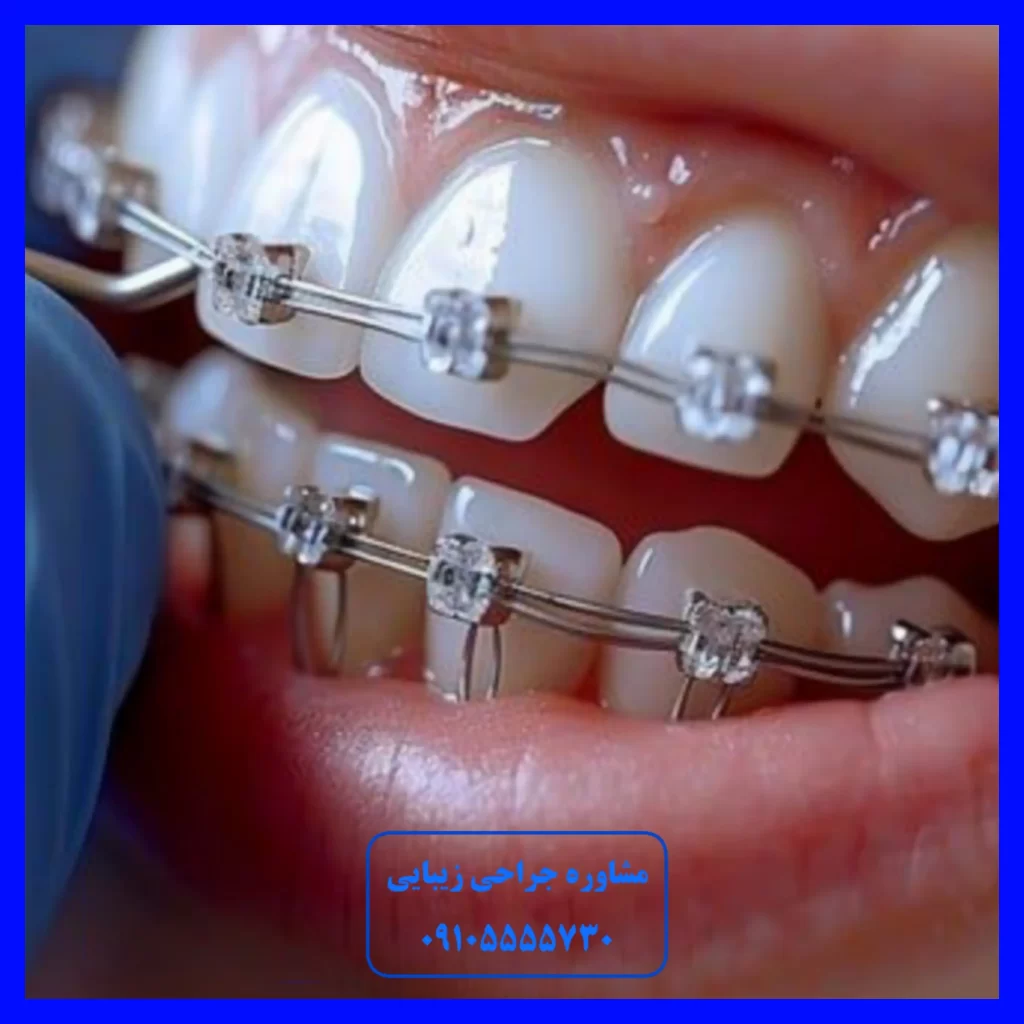 ارتودنسی در تبریز